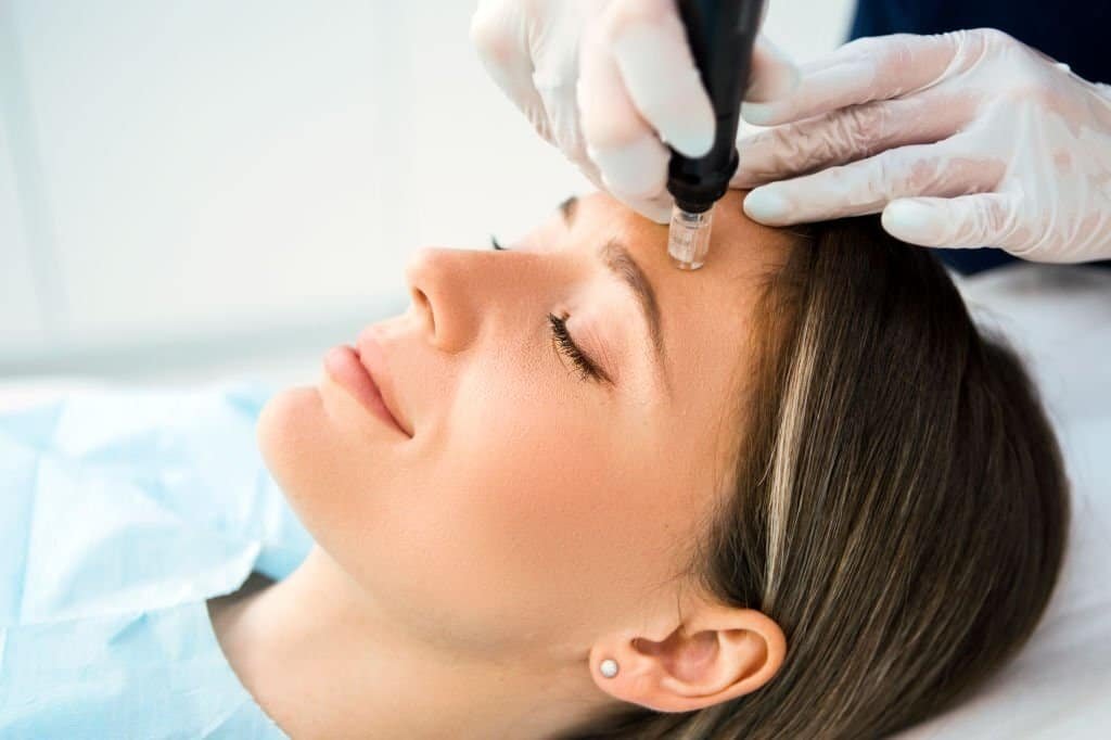 Laser treatment.