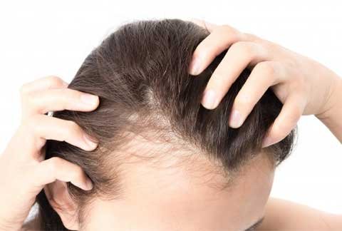 Hair Fall Treatment in Baner: Regain Your Confidence with Dr. Sumit Parsewar